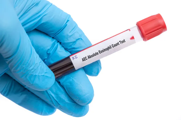 Eosinophil Count Test